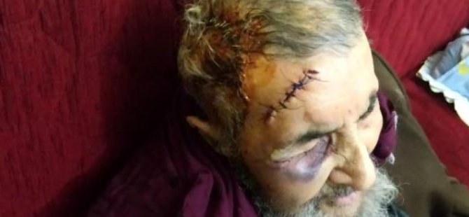 Şişli’de 94 yaşındaki Mevlüt Günbe evinde darp edildi