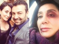 Saruhan Hünel'in darp ettiği Edda Sönmez'e özel koruma