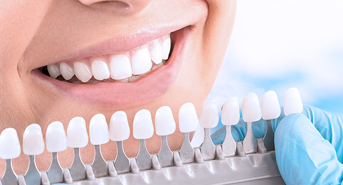 Diş Beyazlatma İşleminde Dikkat Edilmesi Gerekenler
