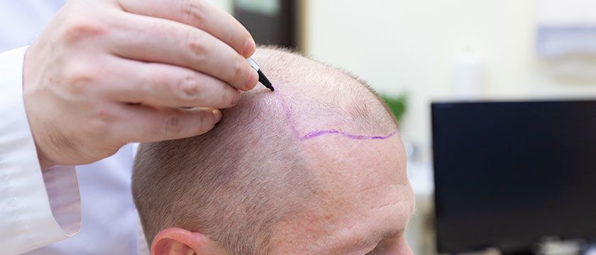 Cilt Gençleştirme Nedir ve Nasıl Yapılır?