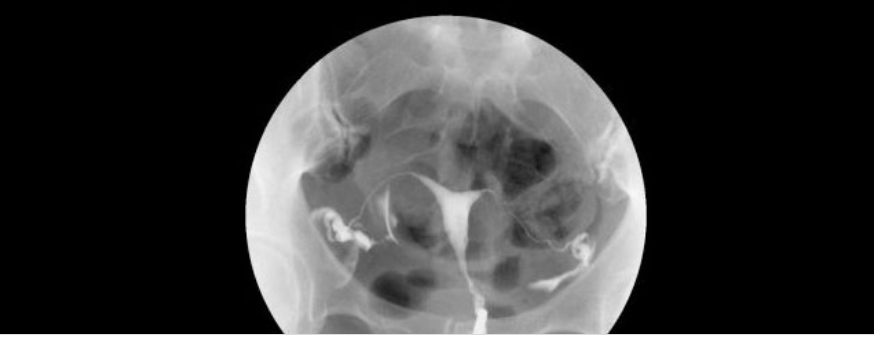 Rahim Filmi Hakkında Bilinmesi Gerekenler Nelerdir?