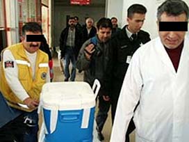 Kopan organı nasıl kurtarabilirsiniz?