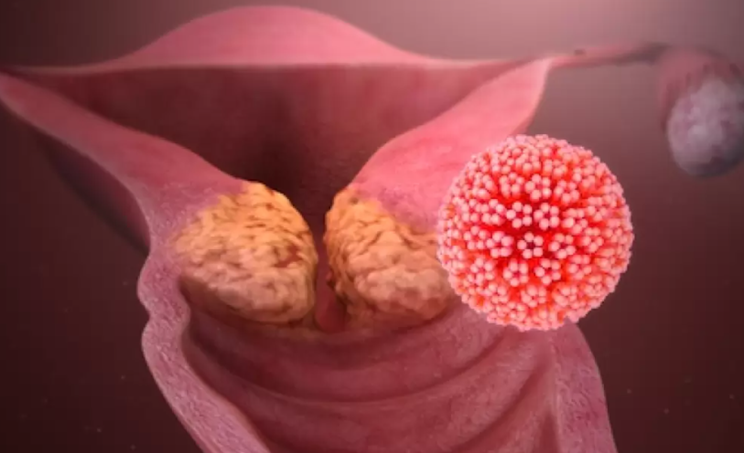 HPV Tehlikeli Midir?