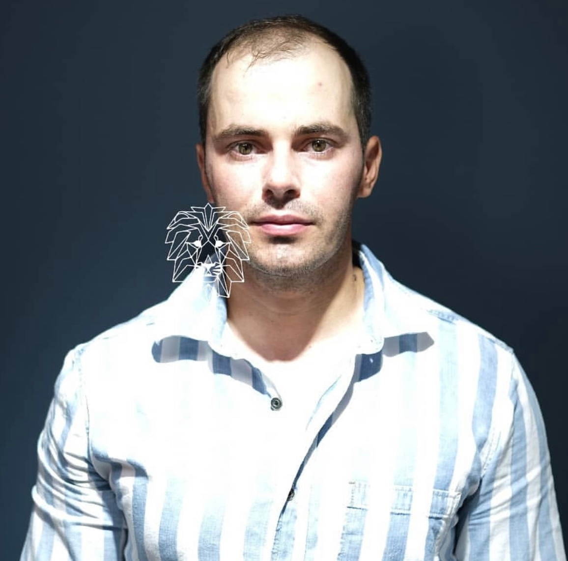 Antalya Saç Ekimi | Haarex Clinic