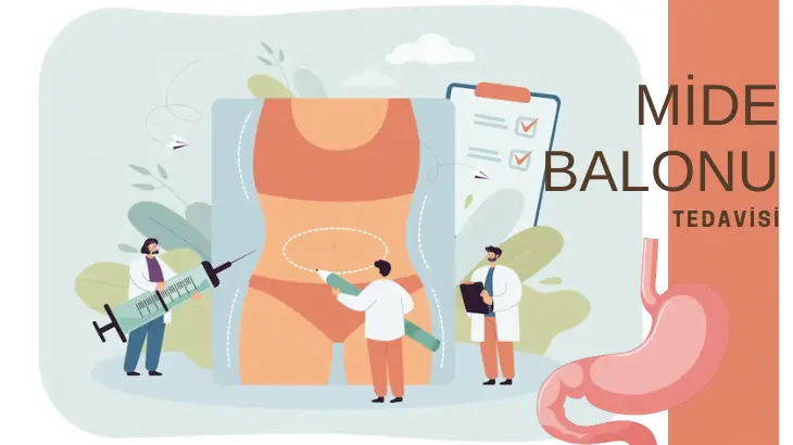 Yutulabilir Mide Balonu Fiyat Neye Göre Belirlenir? Tedavi Süreci ve Detaylar