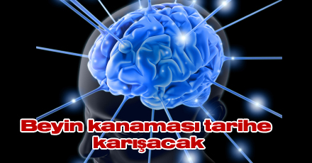 Beyin kanaması tarihe karışacak