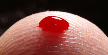 Hepatit B, AIDS'den daha bulaşıcı