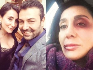 Saruhan Hünel'in darp ettiği Edda Sönmez'e özel koruma